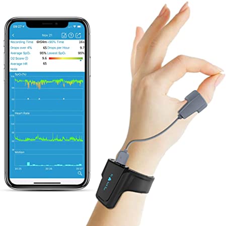 Bild zu ViATOM Bluetooth Schlaf-Sauerstoff-Monitor für 79,99€