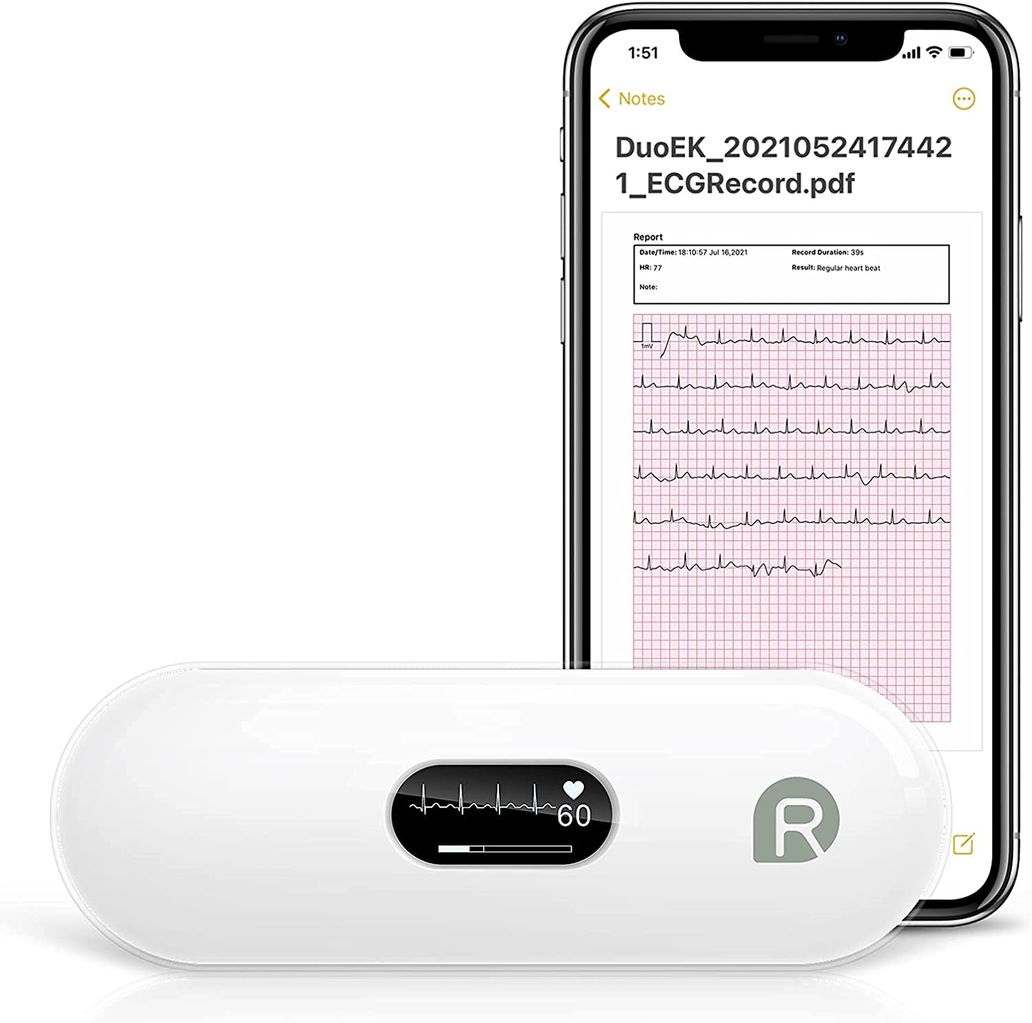 Bild zu Wellue Bluetooth Herzfrequenzmesser für 59,99€