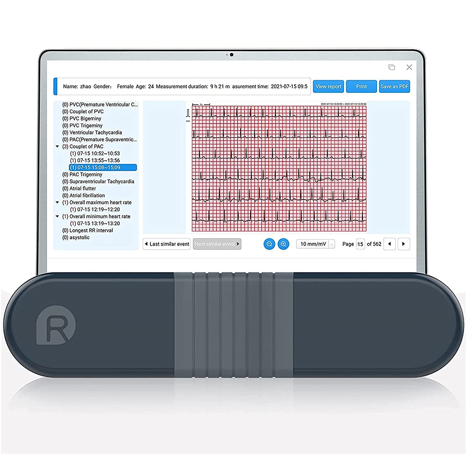 Bild zu Wellue EKG-Monitor mit AI-EKG Analysebericht für 215,99€